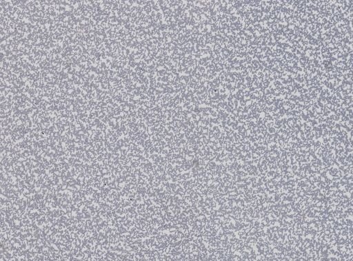 Plasmodium vivax