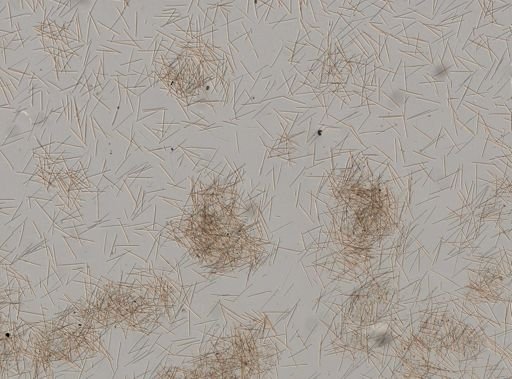 Lissodendoryx cf. (Anomodoryx)
