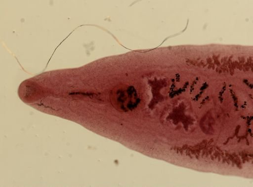 Dicrocoelium dendriticum