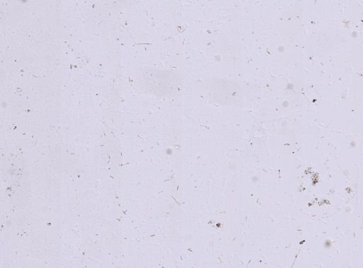 Callyspongia fallax