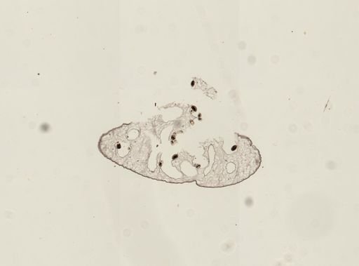 Dicrocoelium dendriticum