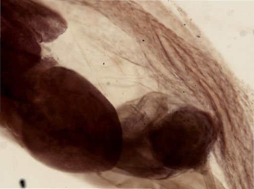 Thamnodrilus crassus