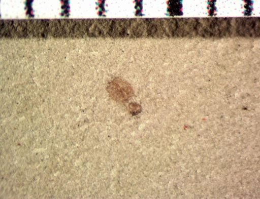Insecta