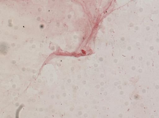 Oxytricha
