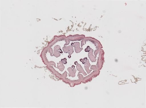 Edwardsia sp.