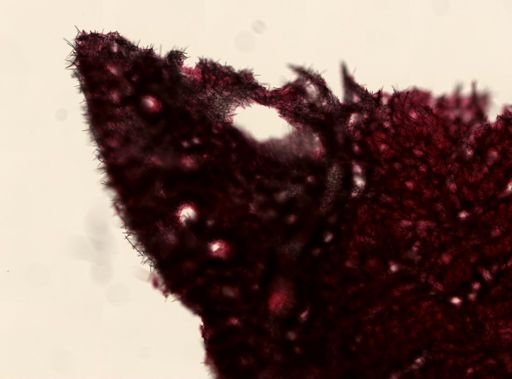 Plakortis