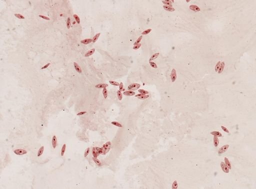 Paramecium caudatum