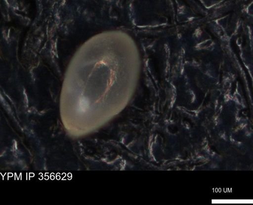 undet. Foraminiferida