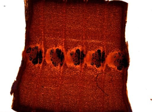 Diphyllobothrium erinacei