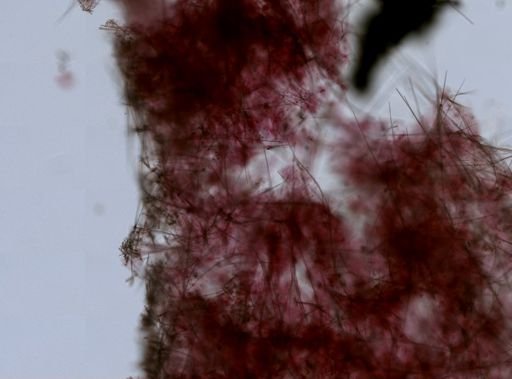 Sympagella nux