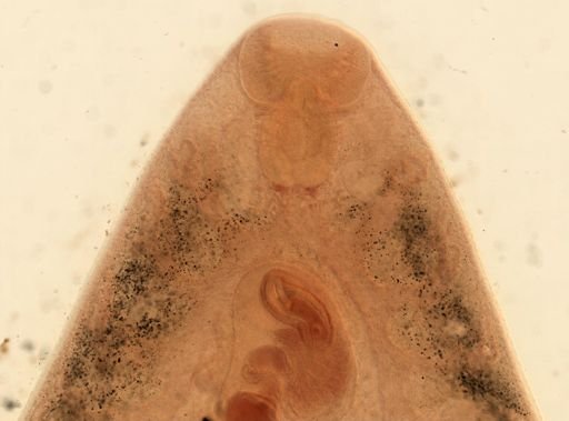 Fasciola hepatica
