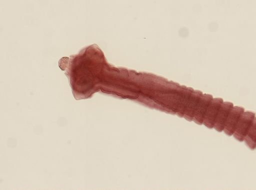 Dipylidium caninum