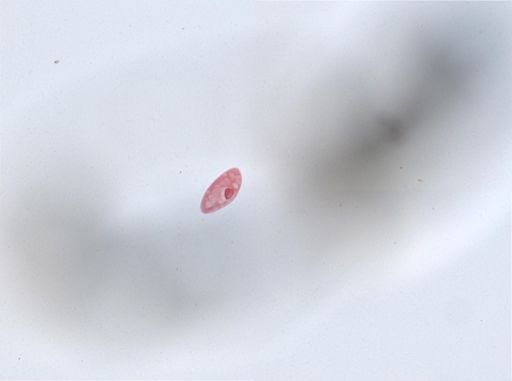 Paramecium aurelia