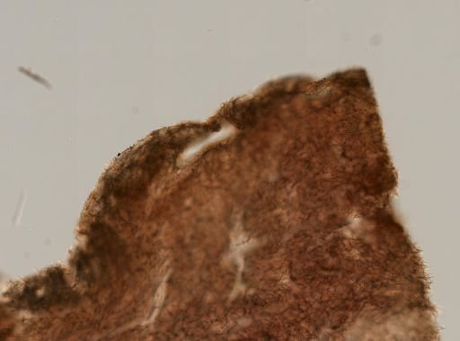 Plakortis sp.