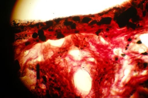 Ircinia strobilina