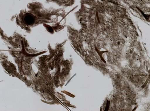 Dictyodendrilla nux