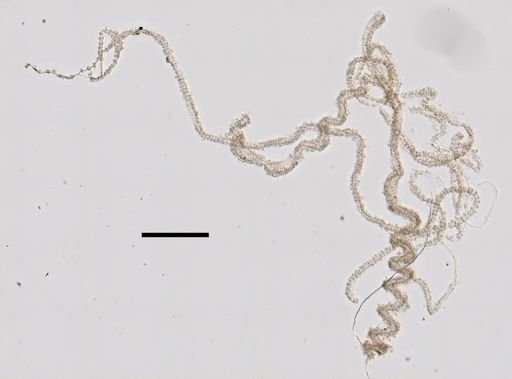 Apolemia rubriversa