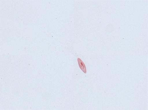 Paramecium aurelia