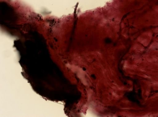 Ircinia