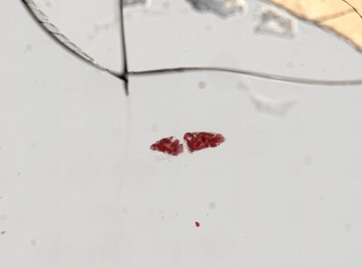 Trematoda