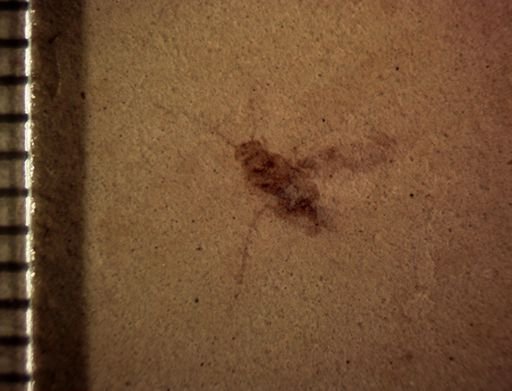 undet. Insecta