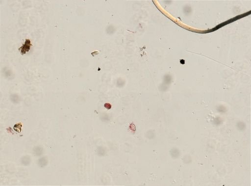 Dicrocoelium dendriticum