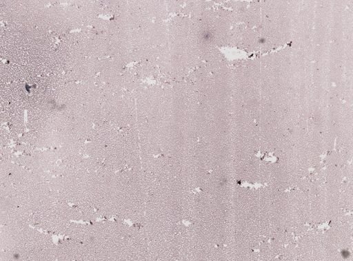 Plasmodium vivax
