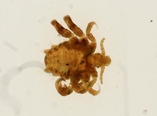 Pthirus pubis