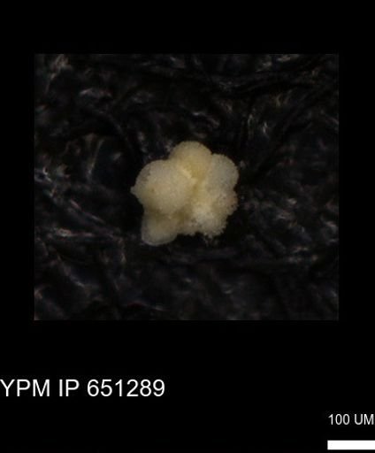 undet. Rugoglobigerinidae