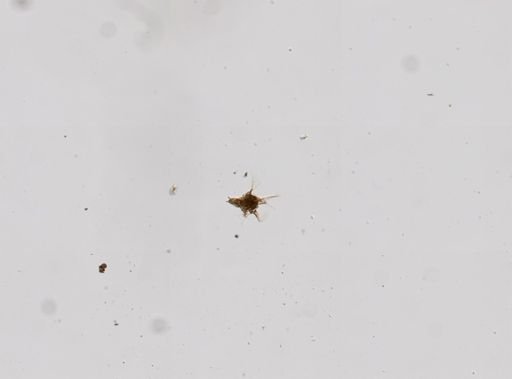 Hexarthra mira