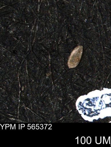 Spirolocammina planula