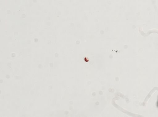 Trematoda