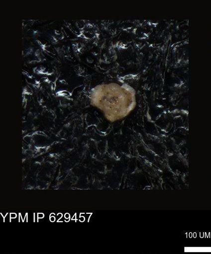 undet. Foraminiferida
