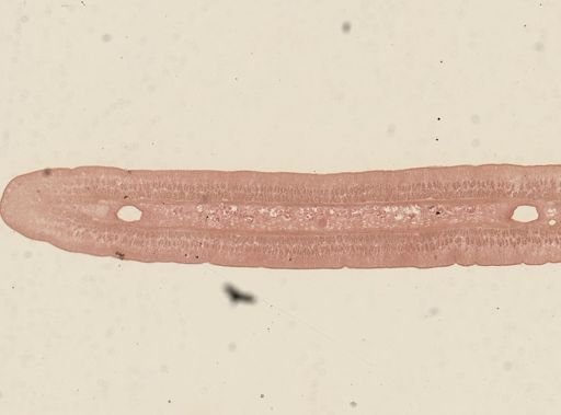 Taenia taeniaeformis