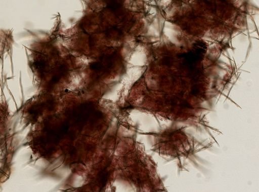 Isodictya deichmannae
