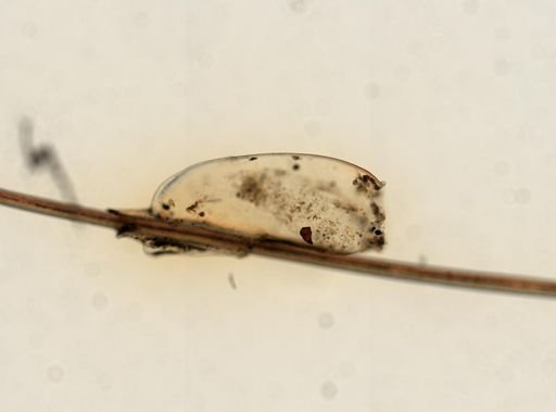 Pediculus humanus