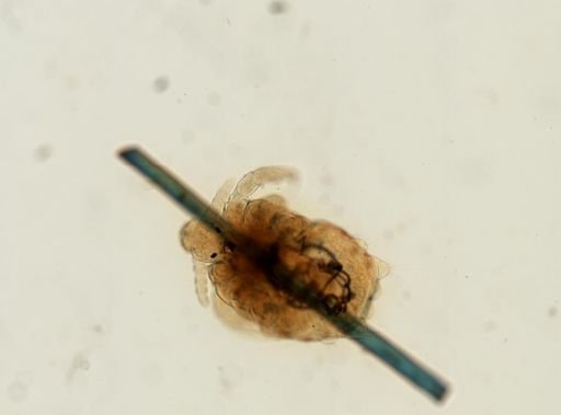 Pthirus pubis