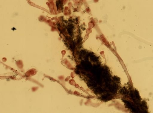 Ephelota