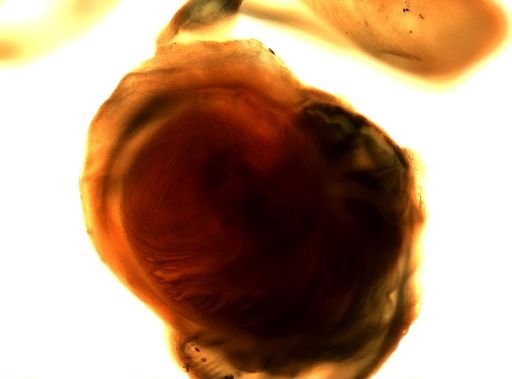 Taenia solium