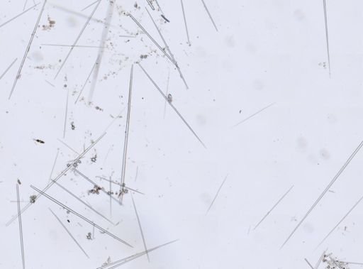 Tethya sp.