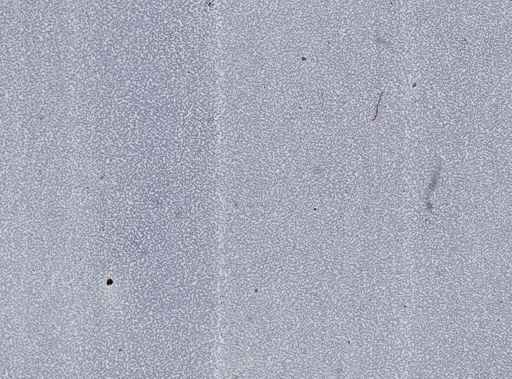 Plasmodium vivax