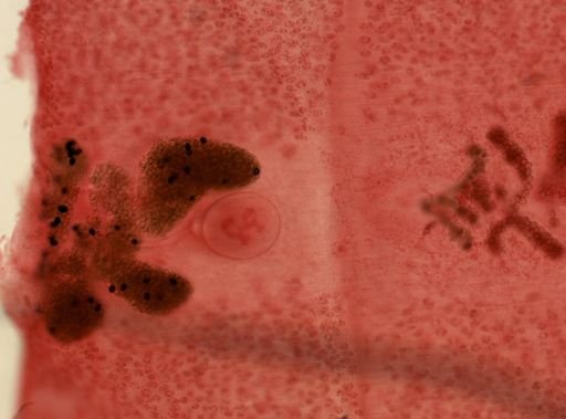 Diphyllobothrium latum