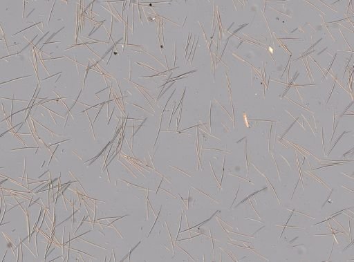 Halichondria bowerbanki