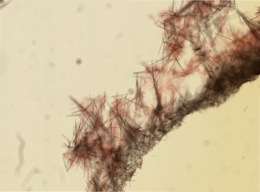 Halichondria panicea