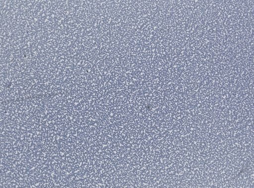 Plasmodium vivax