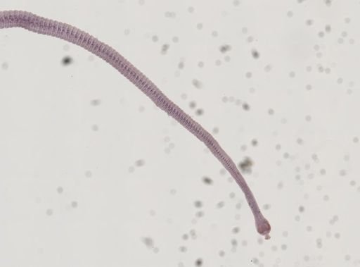 Hymenolepis nana