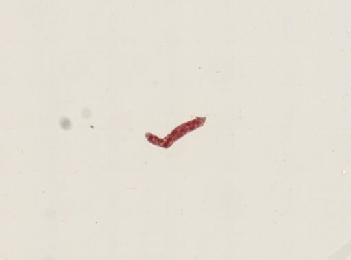 Trematoda