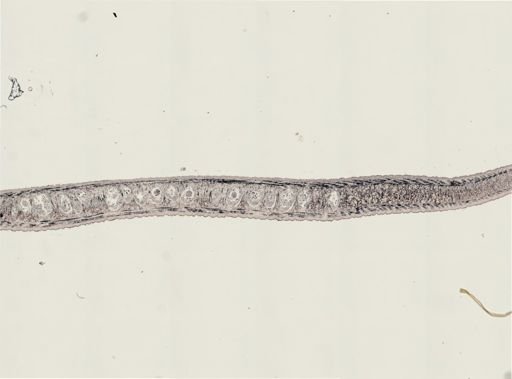 Turbellaria