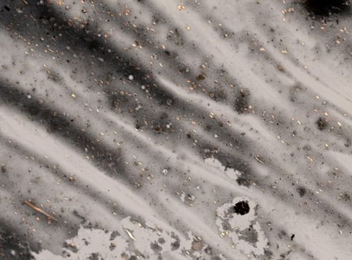 Entamoeba histolytica