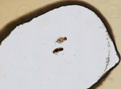 Euchlanis calpidia